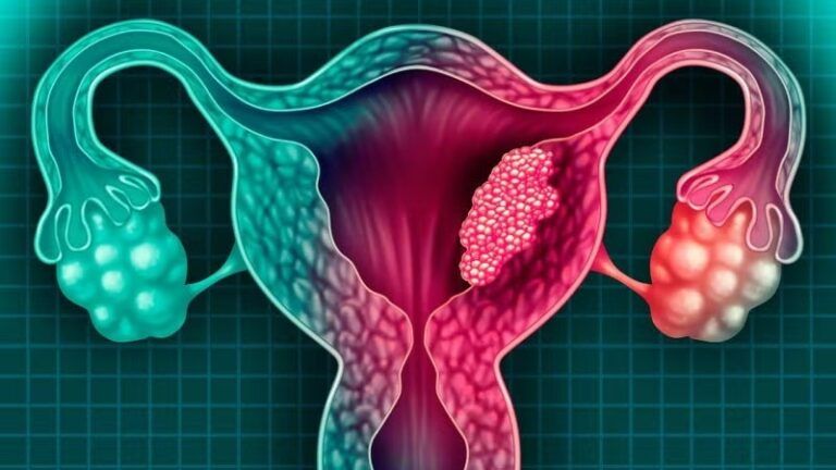 El Enemigo que Podemos Vencer; Cáncer Cervicouterino