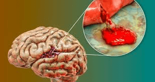Trastornos mentales y enfermedades del corazón: una relación más peligrosa de lo que se pensaba