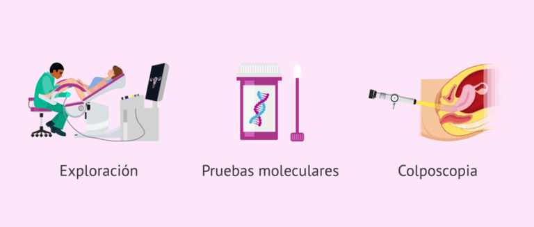 Centros de salud federales pueden mejorar la detección del cáncer cervical